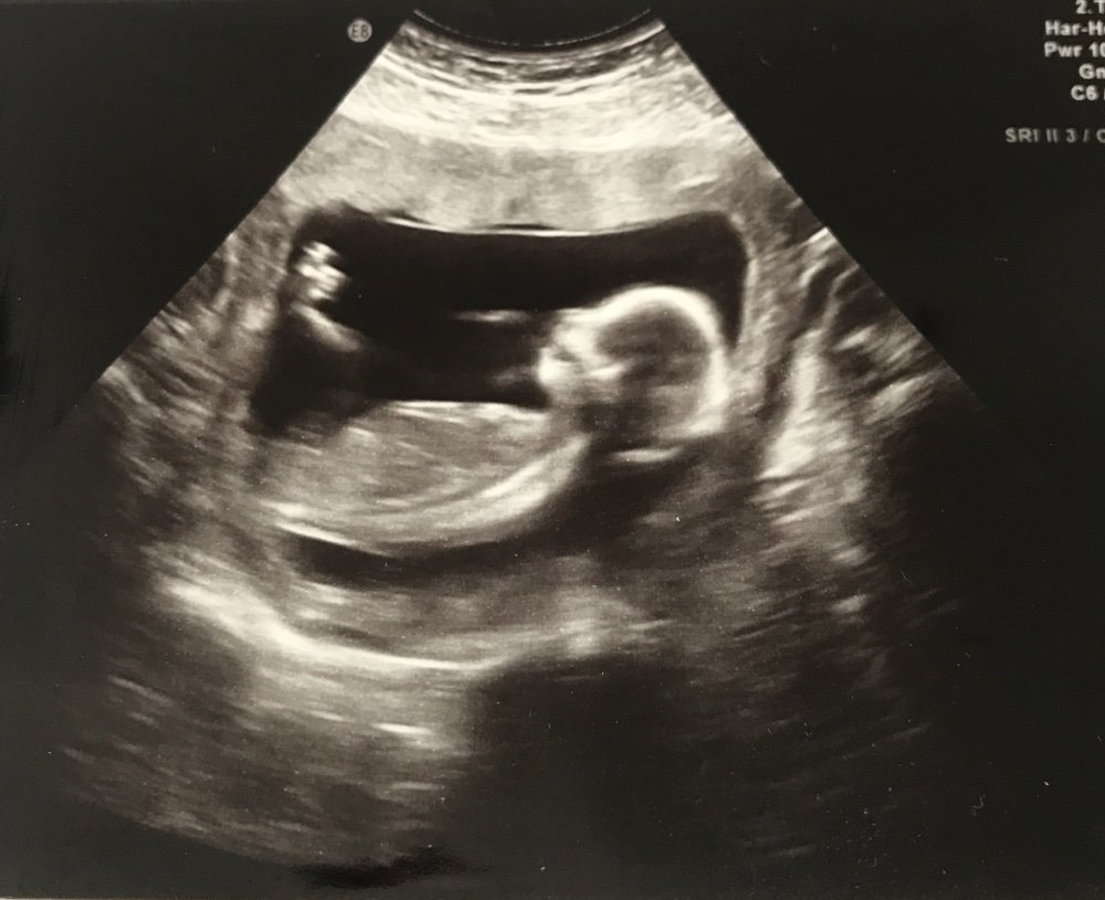 mama gynial ultraschall 1